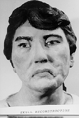 Reconstruction photo